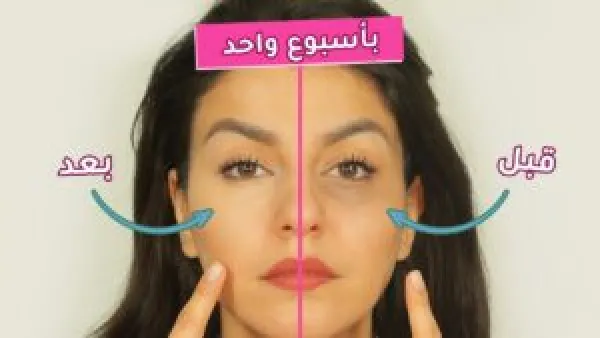 السيروم السحري الذي يتحدث عنه الجميع… واكتشفي سر اختفاء الهالات السوداء في عالم الجمال