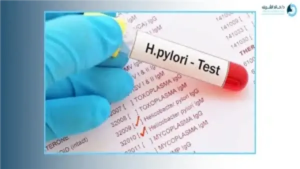 أسعار وأساليب تحليل جرثومة المعدة: كيف تختار الفحص المناسب وتحضر له؟