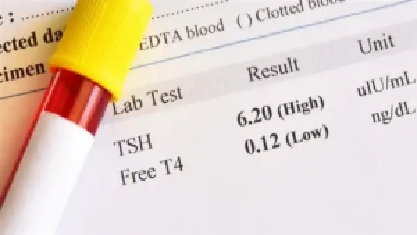 أسعار تحليل الغدة الدرقية في المراكز الطبية وتأثيرها على خيارات الفحص الصحي