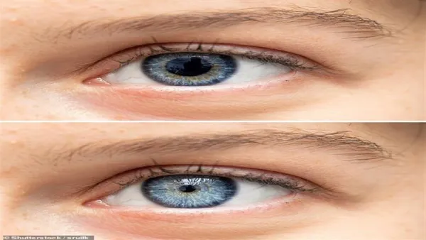 5% من البشر.. اختبار سريع يكشف الإصابة بحالة انعدام التخيل الذهني