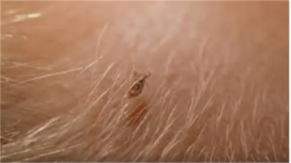 تحذير ابن سيرين.. ماذا تعني رؤية القمل في المنام حسب دلالات الحلم؟