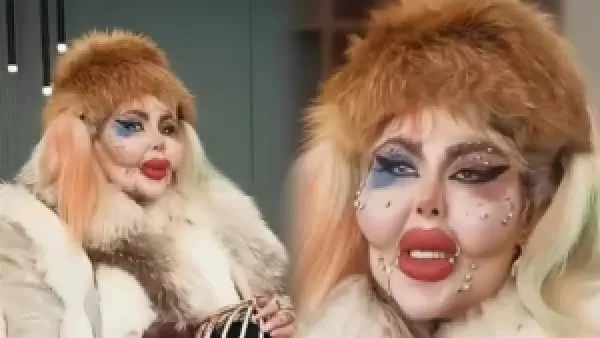 هارلي كوين الإيرانية تثير الجدل بإجرائها 388 عملية تجميل بـ50 مليون دولار واختيار أسلوب حياة بلا طعام سوى القهوة