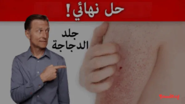 هتبقي بشرة بيبي.. أفضل وصفات طبيعية مجربة لعلاج جلد الوزة وتنعيم البشرة