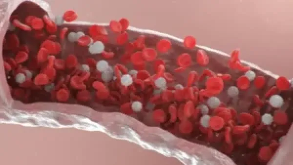 مشاكل الشرايين الخفية تظهر في الليل: كيف تكشف العلامات المبكرة عن خطر صحي يهدد حياتك؟