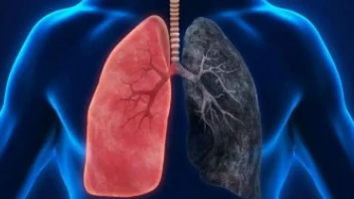 للحد من خطر سرطان الرئة.. 4 إجراءات وقائية يتجاهلها معظم الناس