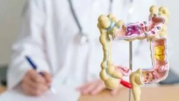 لم يعد مرضًا للمسنين.. سرطان القولون يهاجم الشباب بمعدلات مقلقة.