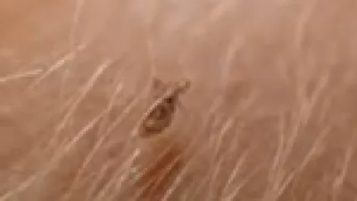 تحذير ابن سيرين.. ماذا تعني رؤية القمل في المنام حسب دلالات الحلم؟