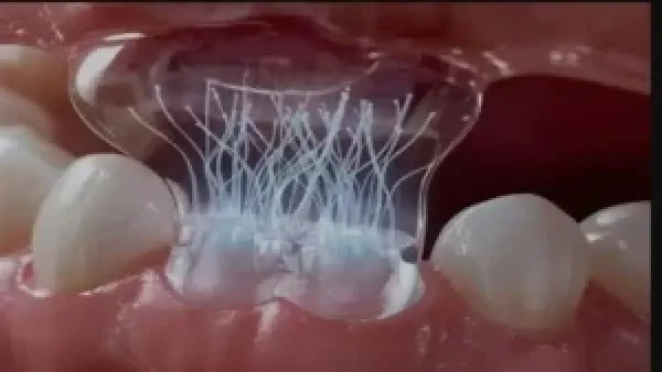 لاصقة بيولوجية تعيد نمو الأسنان بنسبة 100% عبر تحفيز الخلايا الجذعية في الفك