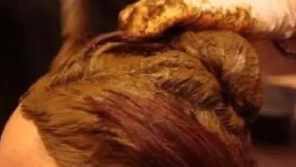 مركب طبيعي في الحناء يظهر نتائج واعدة في مكافحة تليف الكبد.