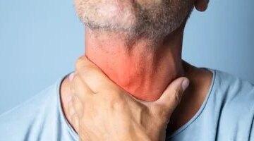 التهاب الحلق لماذا يوصي الأطباء بالعسل والليمون قبل وصف المضادات