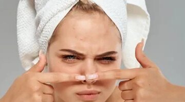 بثور الأنف المستعصية أخطاء شائعة تفاقمها وعلاجات منزلية فعالة تنهي