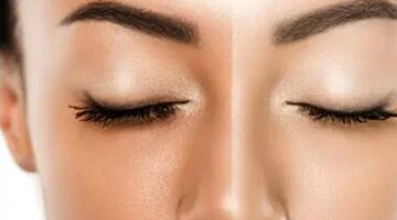 تفتيح البشرة بمكونات من مطبخك قد يغنيك عن الكريمات باهظة