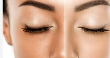 تفتيح البشرة بمكونات من مطبخك قد يغنيك عن الكريمات باهظة الثمن