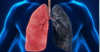 للحد من خطر سرطان الرئة.. 4 إجراءات وقائية يتجاهلها معظم الناس