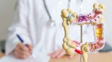 لم يعد مرضًا للمسنين سرطان القولون يهاجم الشباب بمعدلات مقلقة