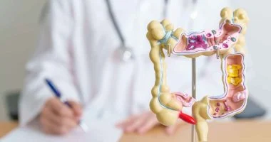 لم يعد مرضًا للمسنين.. سرطان القولون يهاجم الشباب بمعدلات مقلقة.