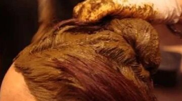 مركب طبيعي في الحناء يظهر نتائج واعدة في مكافحة تليف